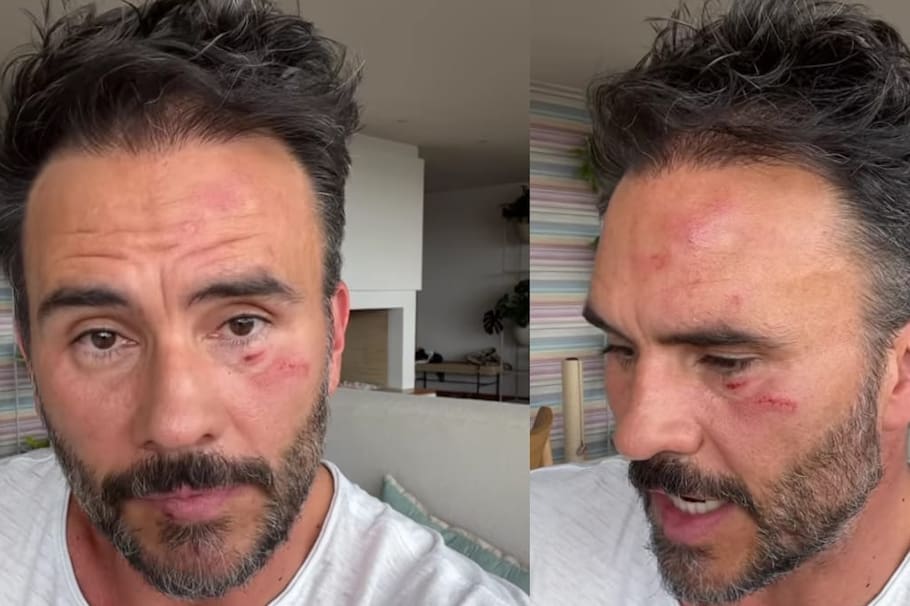 Estas fueron las heridas que los antisociales dejaron a Juan Pablo Raba