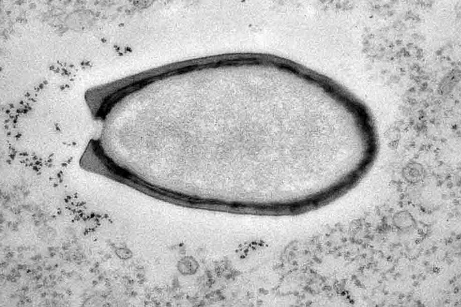 El Pandoravirus mide una milésima de milímetro. Es hasta 20 veces más grande que la media de los virus comunes.