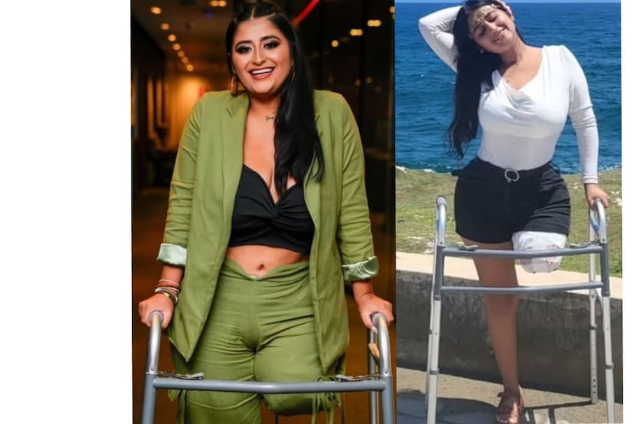 A presentadora colombiana le amputan pierna tras accidente: “Pregunté si me iba a morir”