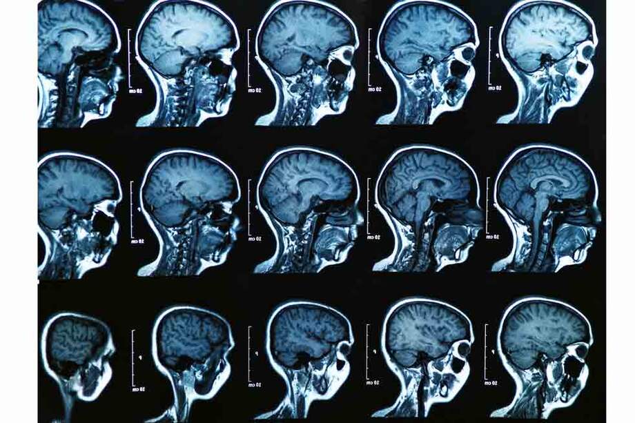 Las personas que se enfrentan a una situación de peligro muestran una enorme capacidad de memoria episódica, el tipo de memoria relacionada con las experiencias personales.