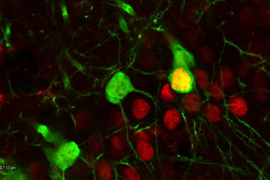 Las neuronas de un circuito cerebral específico que regula el estado de ánimo se tiñen de verde, y el factor de transcripción DeltaFosB, que se encuentra en algunas de estas neuronas del circuito, se marca en rojo.