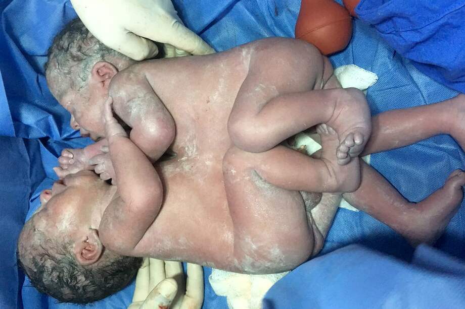 Fotografía cedida por el Instituto Mexicano del Seguro Social (IMSS). / IMSS / EFE