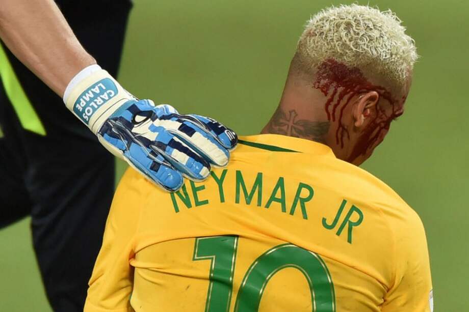 Neymar sufrió un corte en el pómulo derecho tras recibir un codazo. Foto: AFP