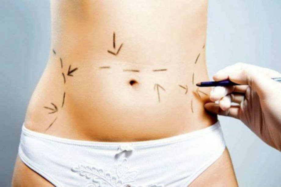 El boom de las cirugías plásticas después de la menopausia