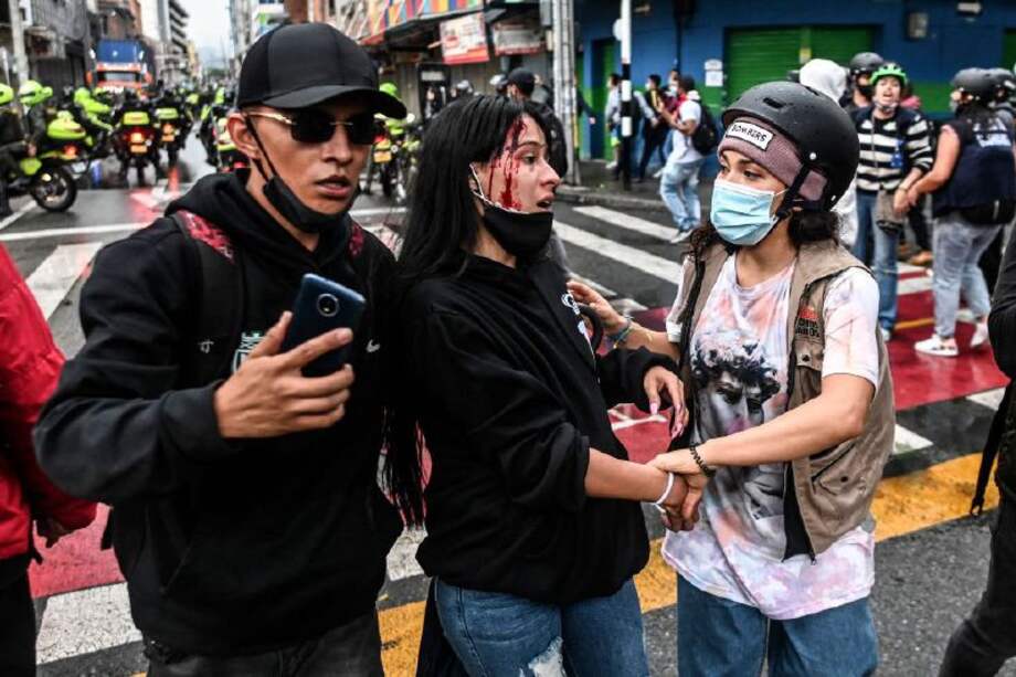 An injured demonstrator is assisted during clashes with riot police following a protest against a tax reform bill launched by Colombian President Ivan Duque, in Medellin, Colombia on April 29, 2021. Workers' unions, teachers, civil organizations, indigenous people and other sectors reject the project that is underway in the Congress, considering that it punishes the middle class and is inappropriate in the midst of the crisis unleashed by the COVID-19 pandemic. / AFP / JOAQUIN SARMIENTO