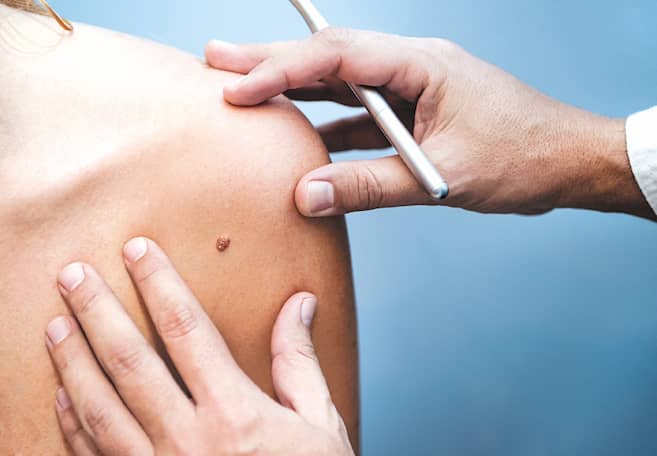 Photo: Elespectador Editorial | Una victoria de la ciencia contra el cáncer de piel