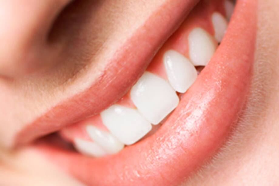 Tips para que tu sonrisa sea la más linda de todas