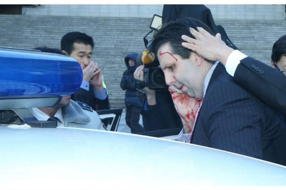 Lippert, de 42 años, fue instalado en un auto policial y transportado al hospital. /AFP