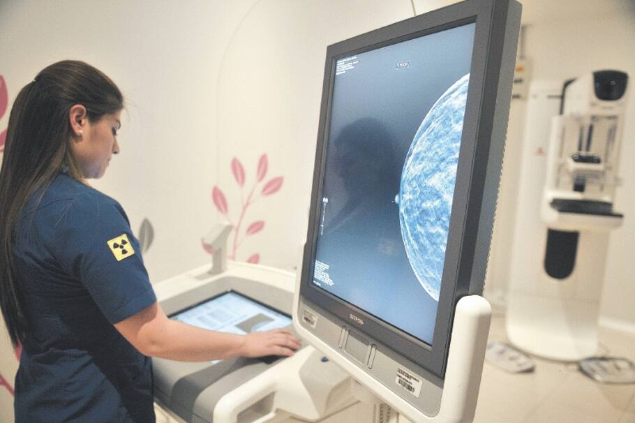 ¿Cuándo se debe hacer una mamografía? La edad no es la que piensa