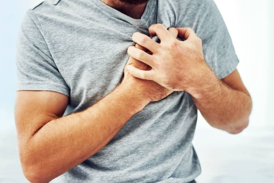 La principal causa de la muerte súbita cardiaca es una arritmia del corazón, (fibrilación ventricular).