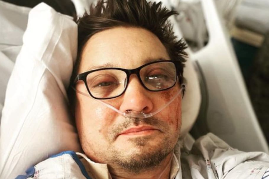 Jeremy Renner publicó una fotografía de su estado tras el accidente que tuvo con una máquina para retirar nieve.