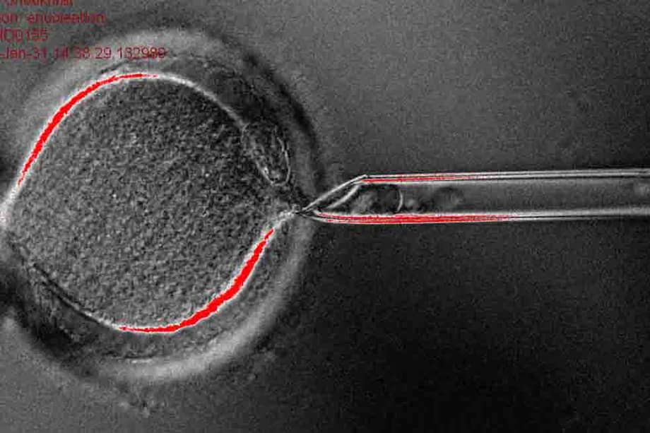 Extracción del núcleo de un óvulo./ npr.org
