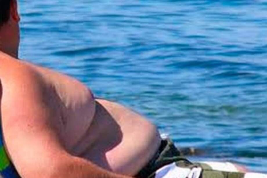 Nueve de los diez países con mayor tasa de obesidad están en el Pacífico