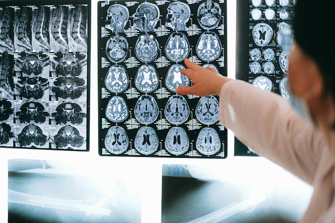 ¿Cómo puede un cerebro hablar dos idiomas? Estos investigadores creen tener una respuesta