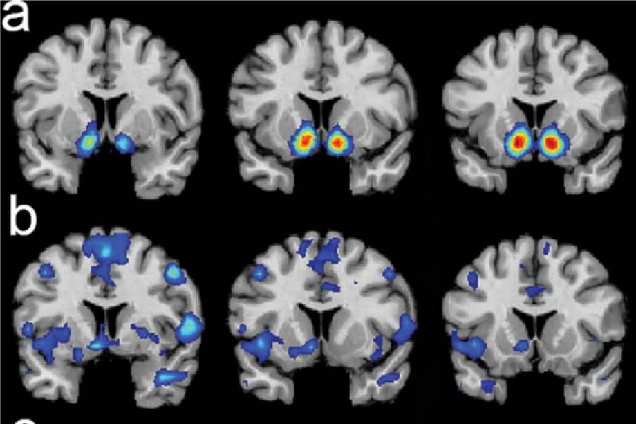 Zonas del cerebro activadas entre mormones al experimentar sentimientos religiosos. / Revista Social Neuroscience.