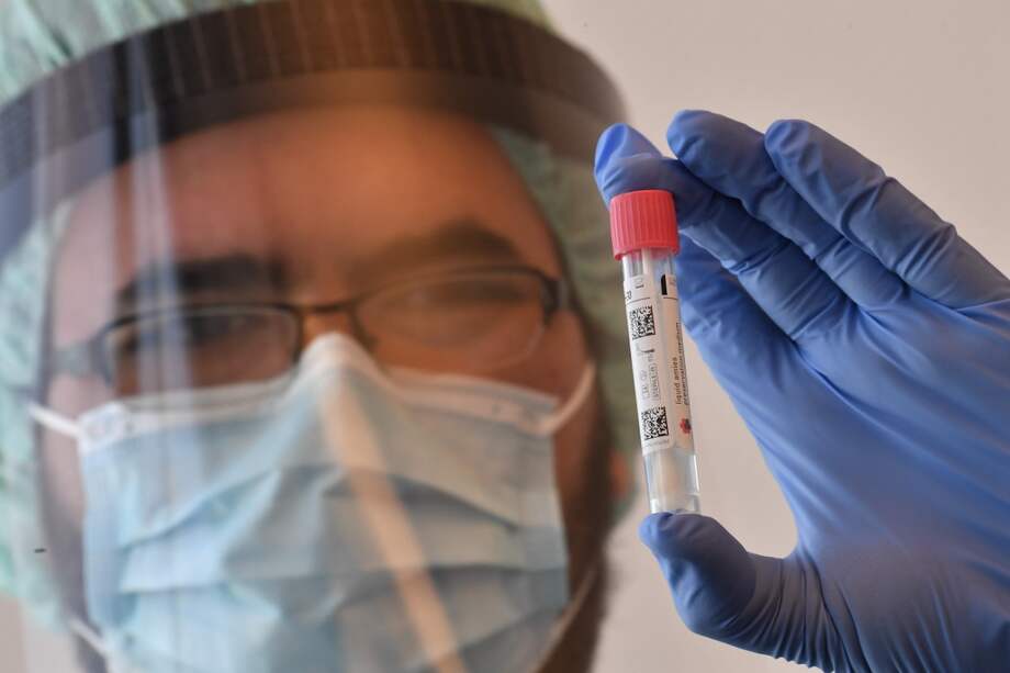 Prueba de coronavirus