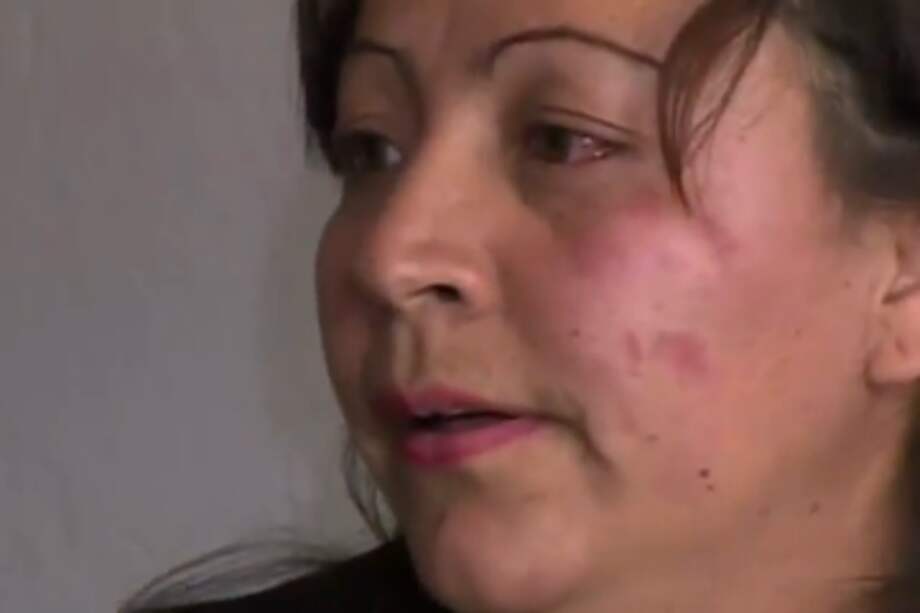 Hombre que atacó a compañera con ácido ya consiguió nuevo trabajo