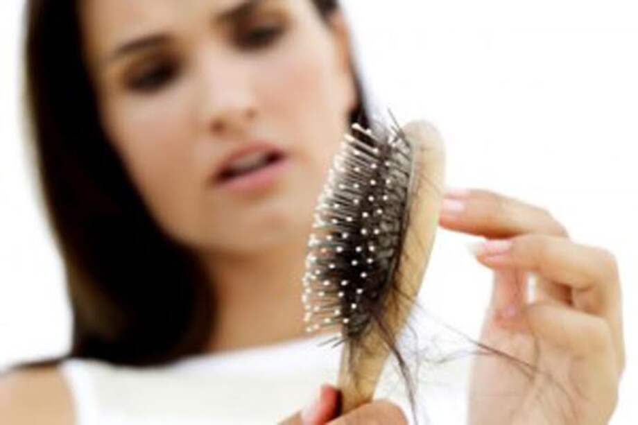 Alopecia, a ellas también las ataca