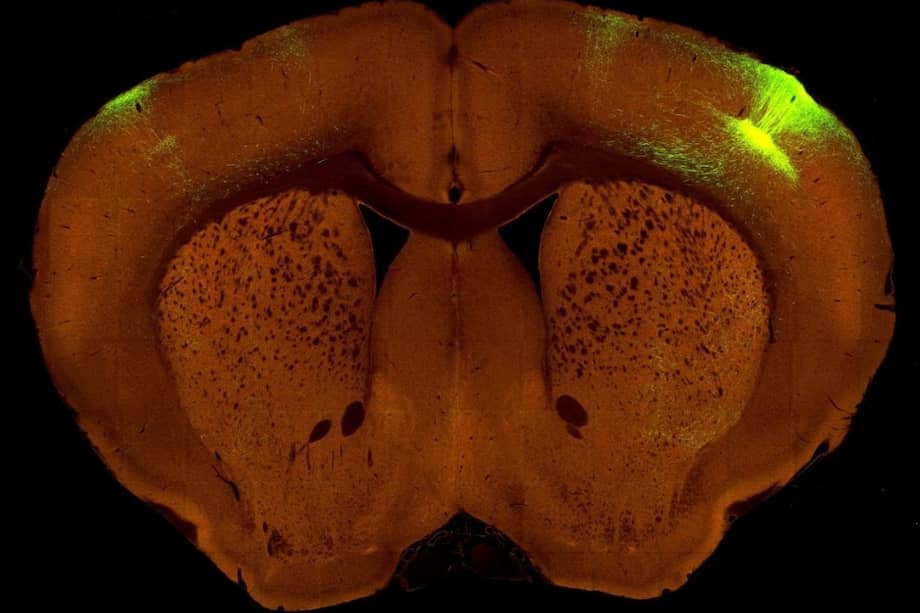Así luce el nuevo mapa de cómo está conectado el cerebro. / Allen Institute