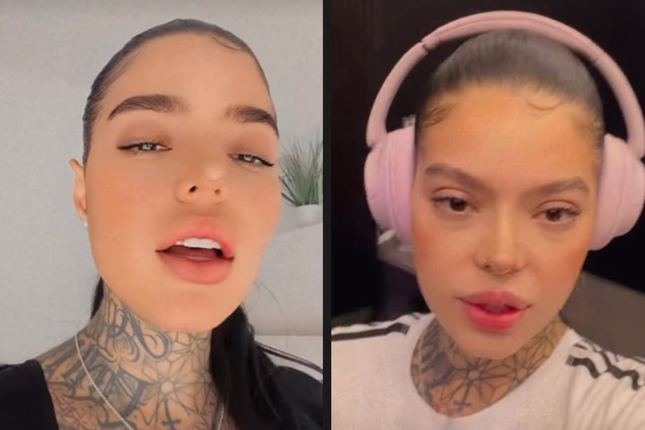 La finalista del reality de convivencia mostró el resultado de su reciente cirugía estética.