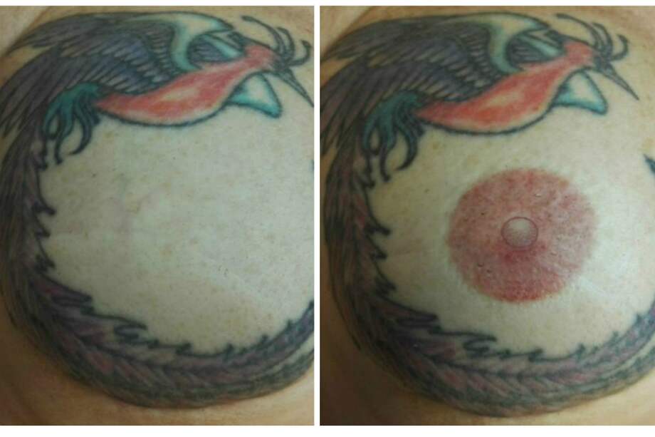 Jo Storey es peluquera y llevaba 17 años sin pezón en su pecho derecho. La foto muestra el antes y después de la técnica en 3D. / Claire Louise