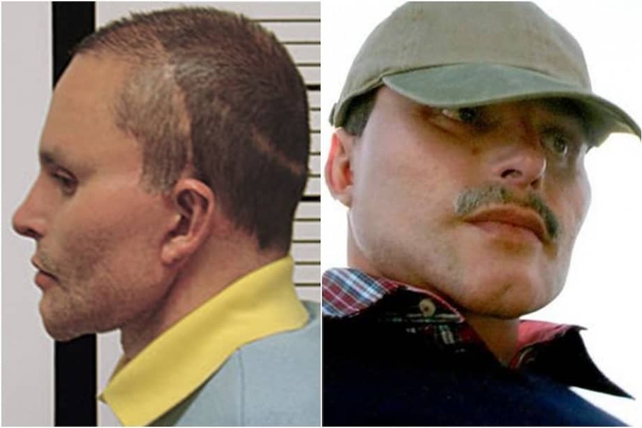 Alias Chupeta se realizó múltiples cirugías plásticas para ocultar su identidad.