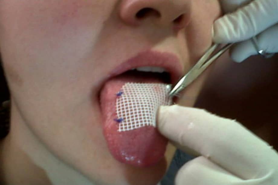 Invima advierte que 'malla para adelgazar' está prohibida