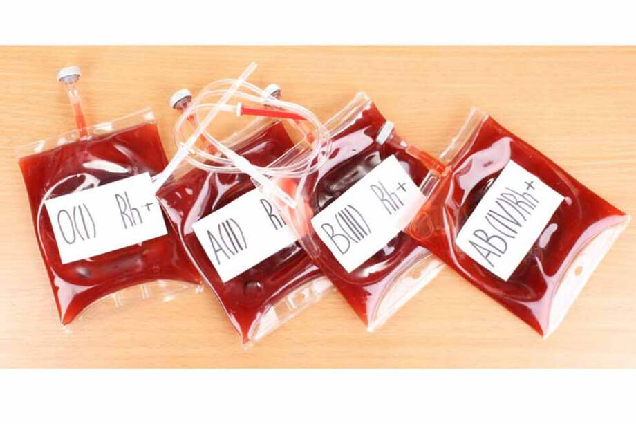 Ambrosia anunció la apertura de clínicas en seis ciudades. Los beneficios del tratamiento de transfusión de sangre para rejuvenecer, hasta el momento, no están documentados y podrían tener riesgos. / Getty Images