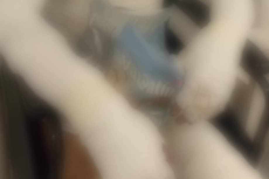 Manuel Sebastián Guerra, vecino de la localidad de Bosa, que resultó quemado tras conflagración en estación de Policía de Choachí.