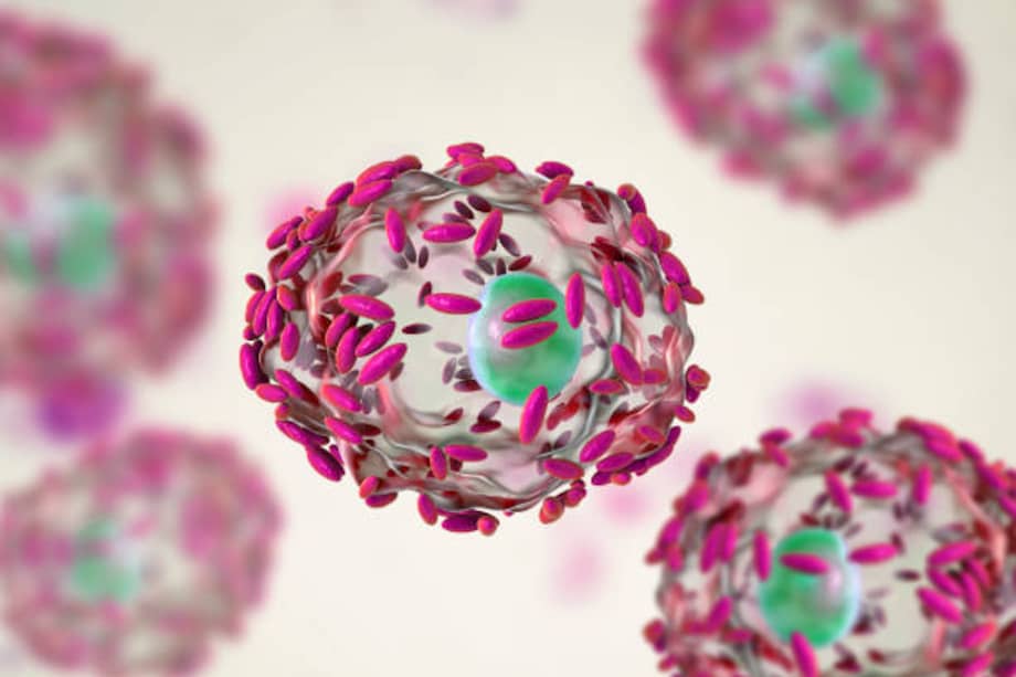 Ilustración computarizada de bacterias Gardnerella vaginalis (bacilos) adheridas a células epiteliales, conocidas como células clave. G. vaginalis es una de las especies bacterianas que causan vaginosis. /Getty