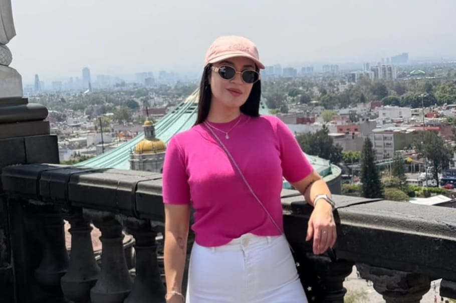 La también creadora de contenido narró la terrible experiencia, tras una fuga de gas. Mostró imágenes de cómo quedó su cuerpo.