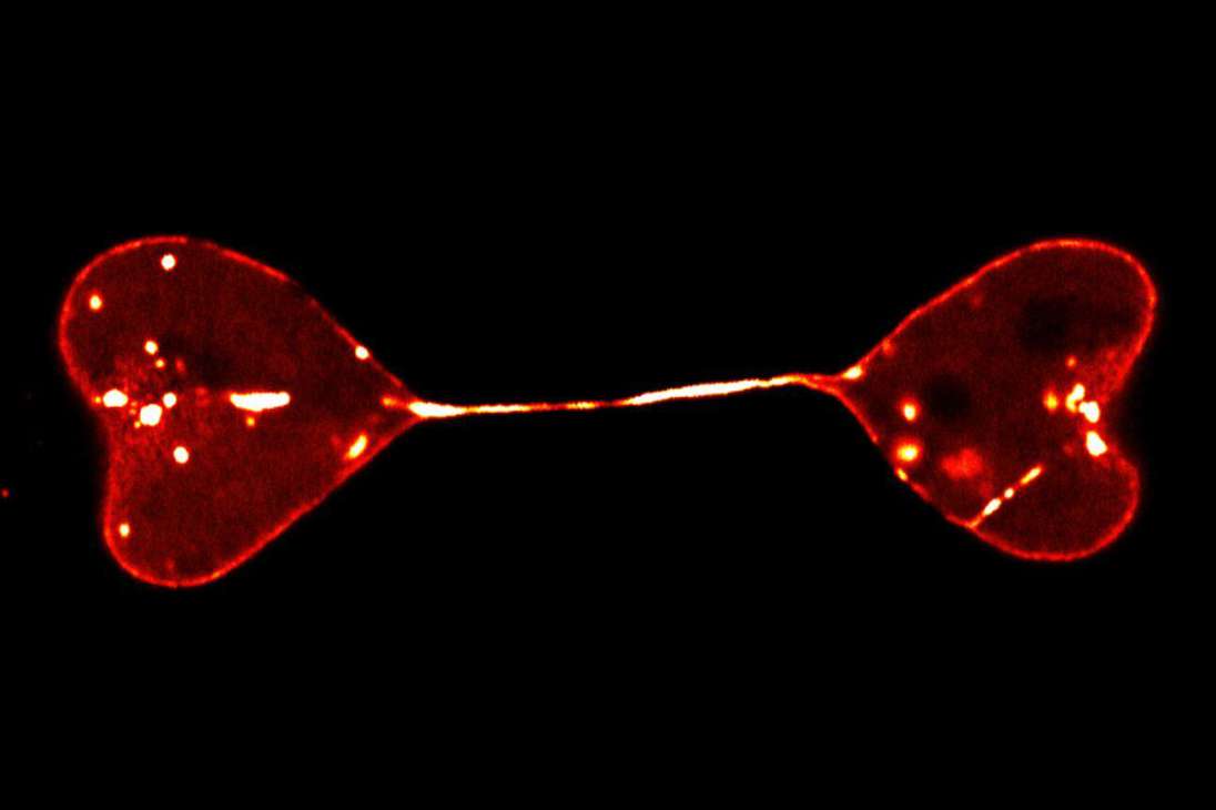 Núcleos semiseparados de dos células que forman dos corazones. / Di Lu (China).