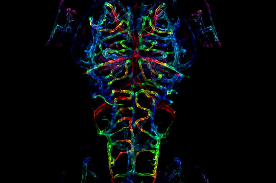 El sistema nervioso en desarrollo de un pez cebra embrionario. / LayraCintron-Rivera (EU).