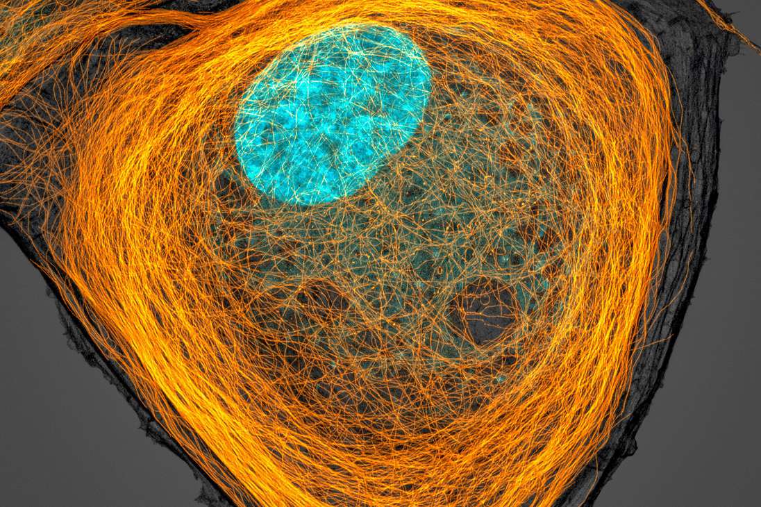 Una fotografía tomada a un 63X de aumento que muestra en detalle una célula, sus microtúbulos (naranja) y su núcleo (azul) se llevó el séptimo lugar en la competencia.