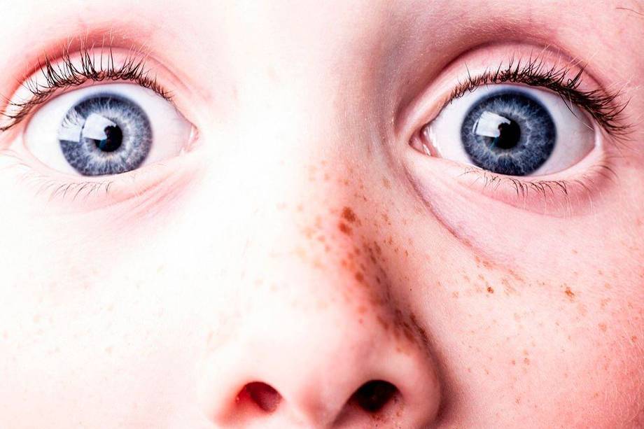 La visión se desarrolla hasta los 7 años, por lo tanto, es importante llevar a todos los niños antes del año a una valoración oftalmológica para descartar problemas refractivos que pueden desencadenar en una ambliopía u ‘ojo perezoso’.