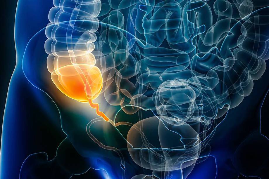 signos tempranos de apendicitis en hombres