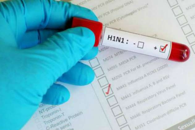 Una persona murió a raíz del virus AH1N1 en Antioquia