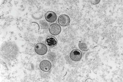 Imagen microscópia del monkeypox.