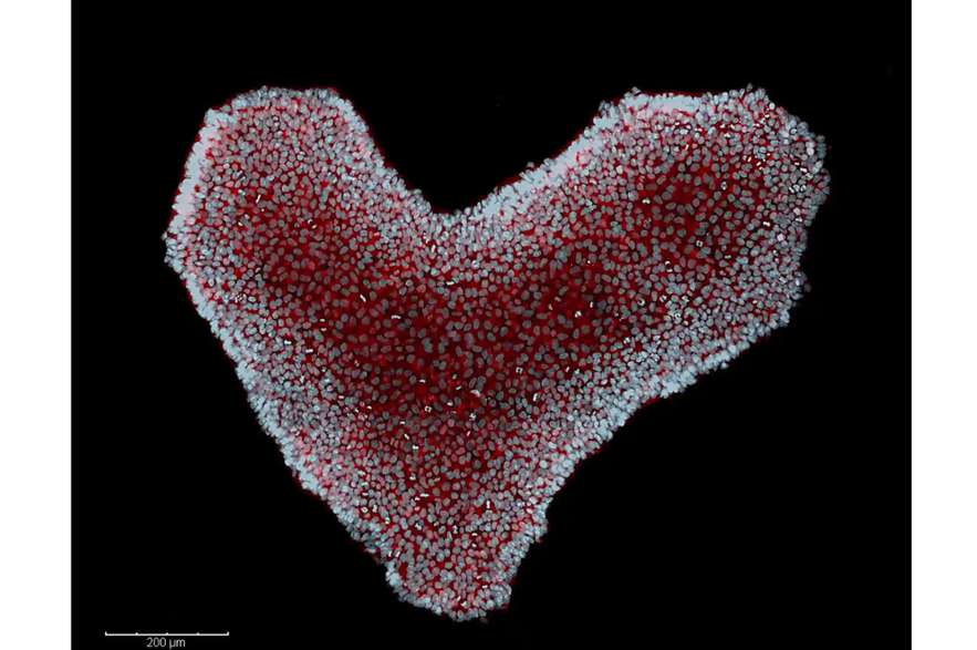 "Colonia de células madre embrionarias humanas en forma de corazón", escribió el Instituto sobre la imagen.