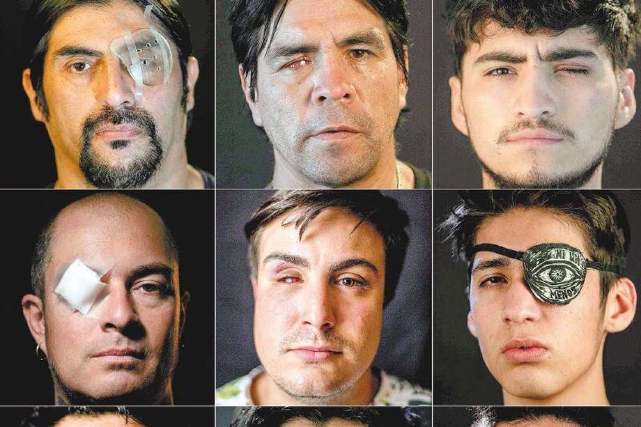 Las víctimas de lesiones oculares que dejaron las protestas en Chile aún no han sido reparadas por el Estado. / AFP