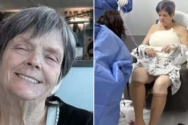 Mujer fue a México para cirugía de piel y despertó con aumento de senos y glúteos