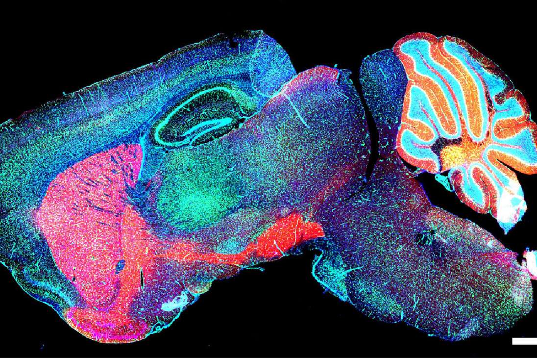 Neuronas GABA (ácido gamma-aminobutírico) del cerebro de un ratón. / Yayun Wang (China).