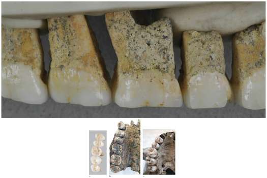 Dentadura del Homo luzonensis. / / © Callao Cave Archaelogy Projet