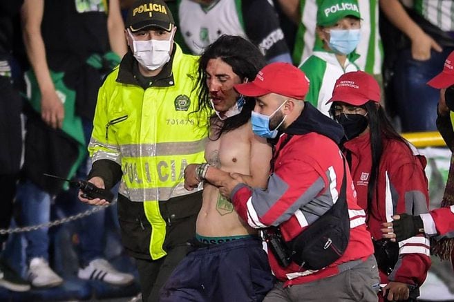 Santa Fe defenderá al hincha que fue atacado por aficionados de Nacional |  EL ESPECTADOR