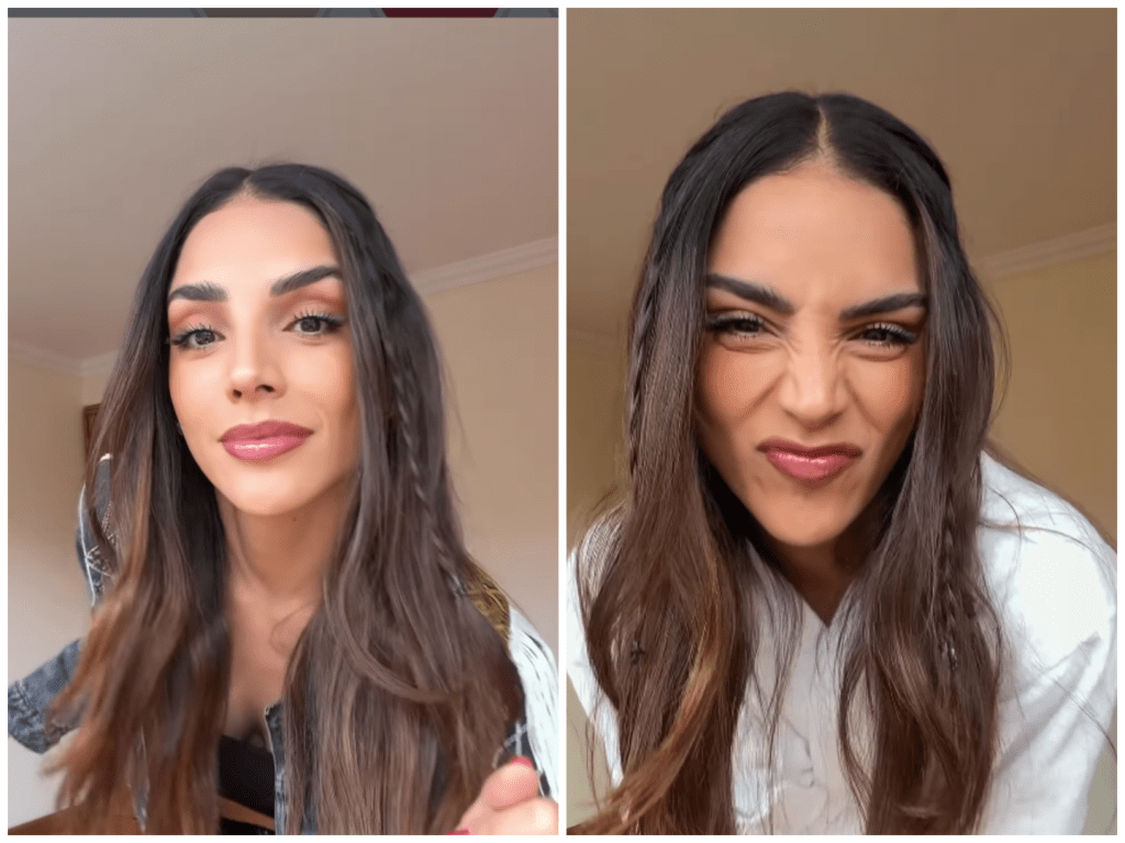 La ex Señorita Colombia y actriz dialogó con Vea sobre el proceso emocional que vivió tras retirarse, por recomendación médica, el característico lunar que hizo parte de su rostro y de la imagen con la que el público la identificaba.