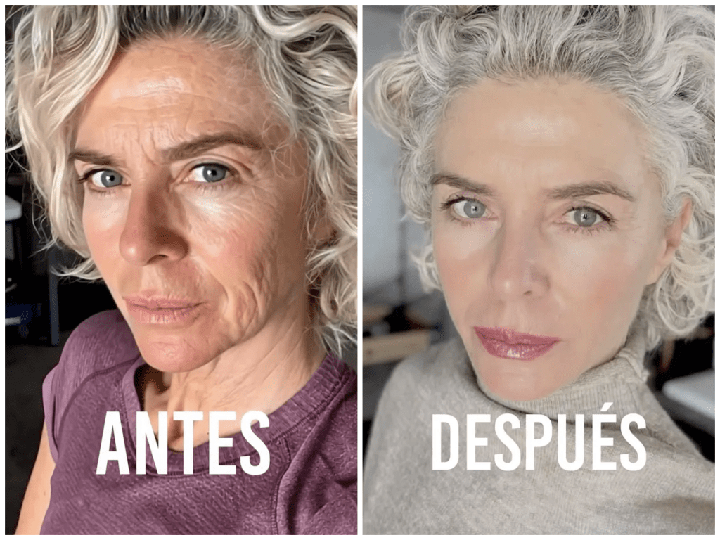 La actriz de 61 años mostró el resultado del tratamiento facial que se realizó: “Espectacular”, comentaron los internautas. Imágenes.