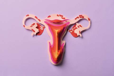 Endometriosis: abrazar el dolor