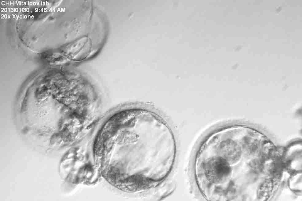 Científicos de la Universidad y el Centro de Investigación Nacional de Primates de Oregon reprogramaron con éxito células de piel humana para convertirlas en células madre embrionarias capaces de transformar en cualquier otro tipo de célula en el cuerpo. / EFE