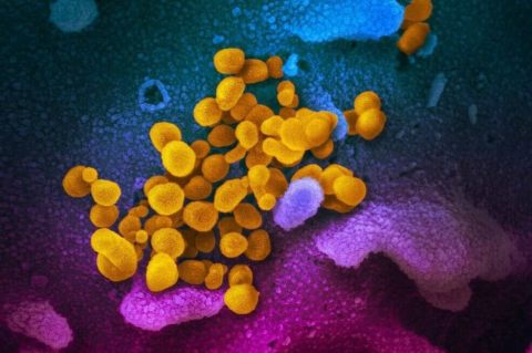 Coronavirus habría llegado a Colombia en febrero, un mes antes de confirmar el primer caso