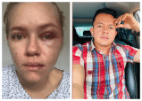 Alertan demora en denuncia por violencia contra el concejal de Ocaña Deiby Arias